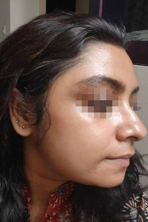 Aditi - after