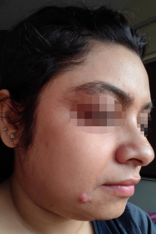 Aditi - before