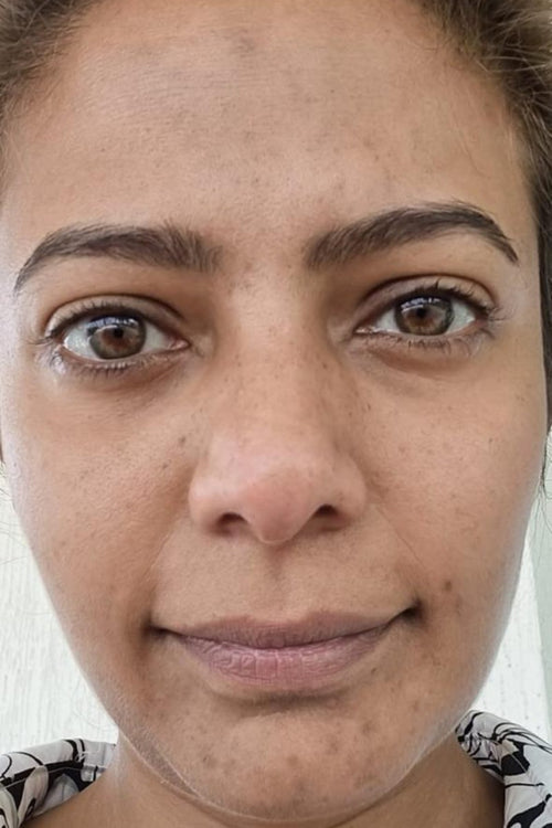 Ananya - before