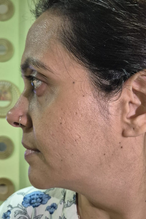 Divya - before