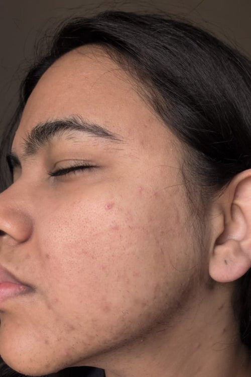Ishani - before