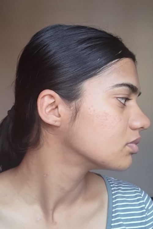Meera - after