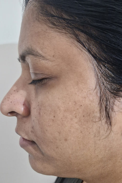 Nisha - before