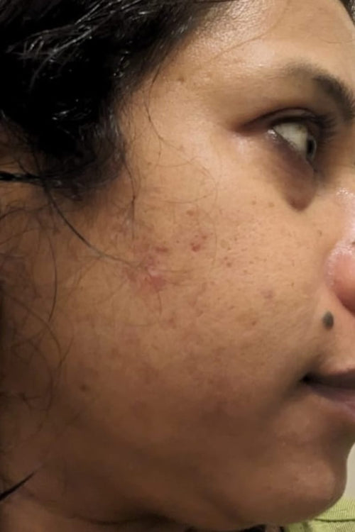 Priya - before