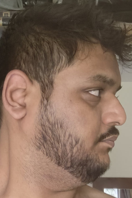 Rahul - after