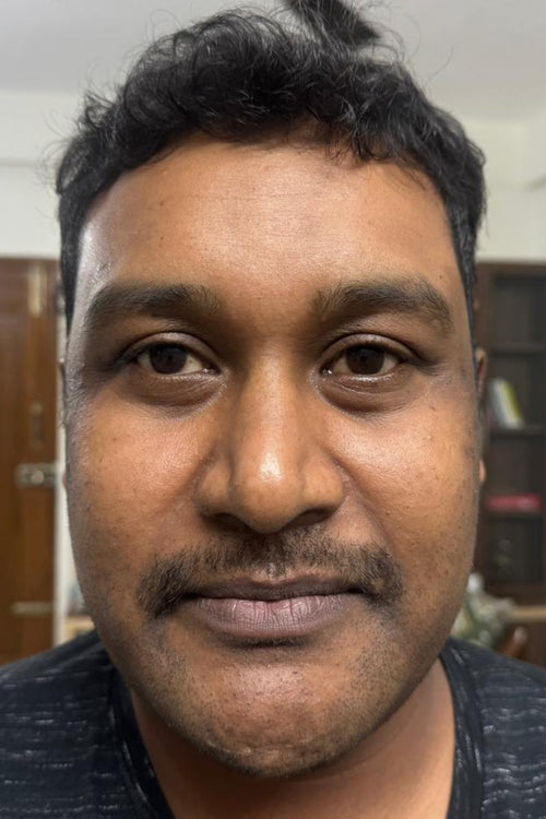 Ravi - before