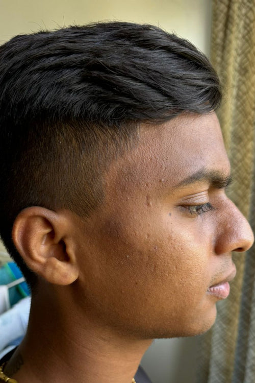 Vikram - before
