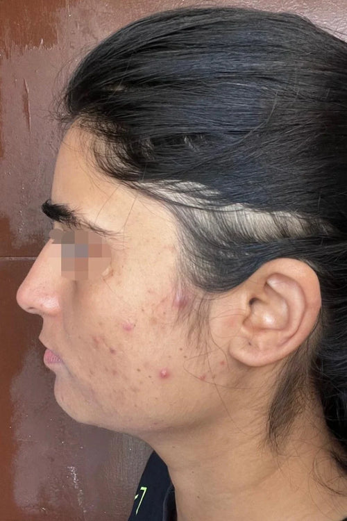 Yashvi - before