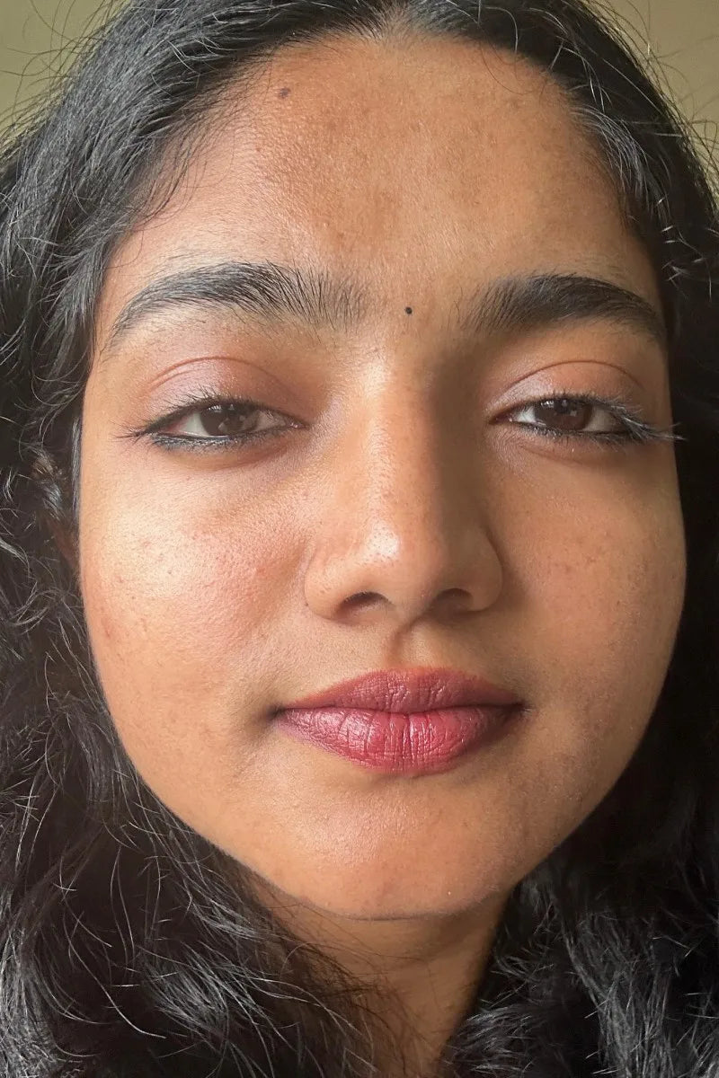 Aarohi, Mumbai after treatment
