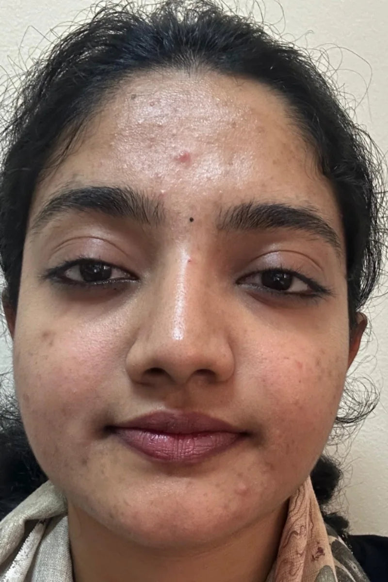Aarohi, Mumbai before treatment