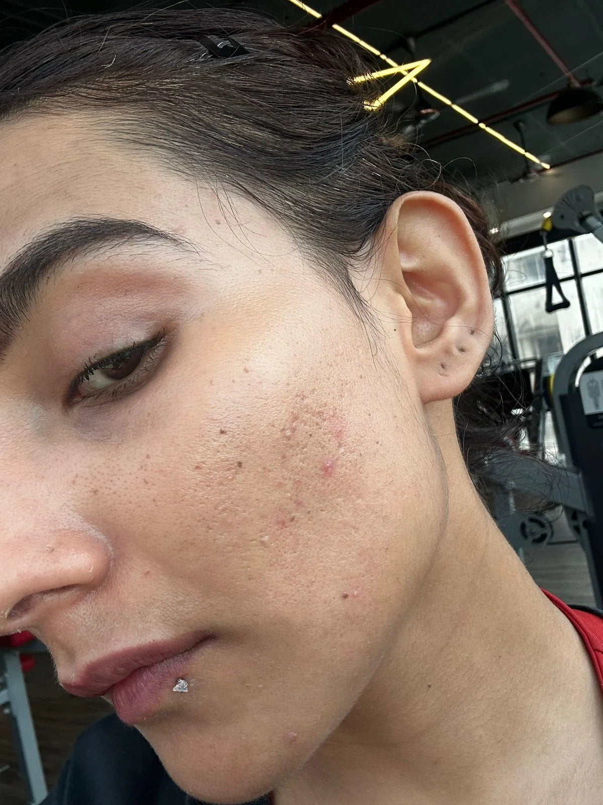 Sneha after treatment
