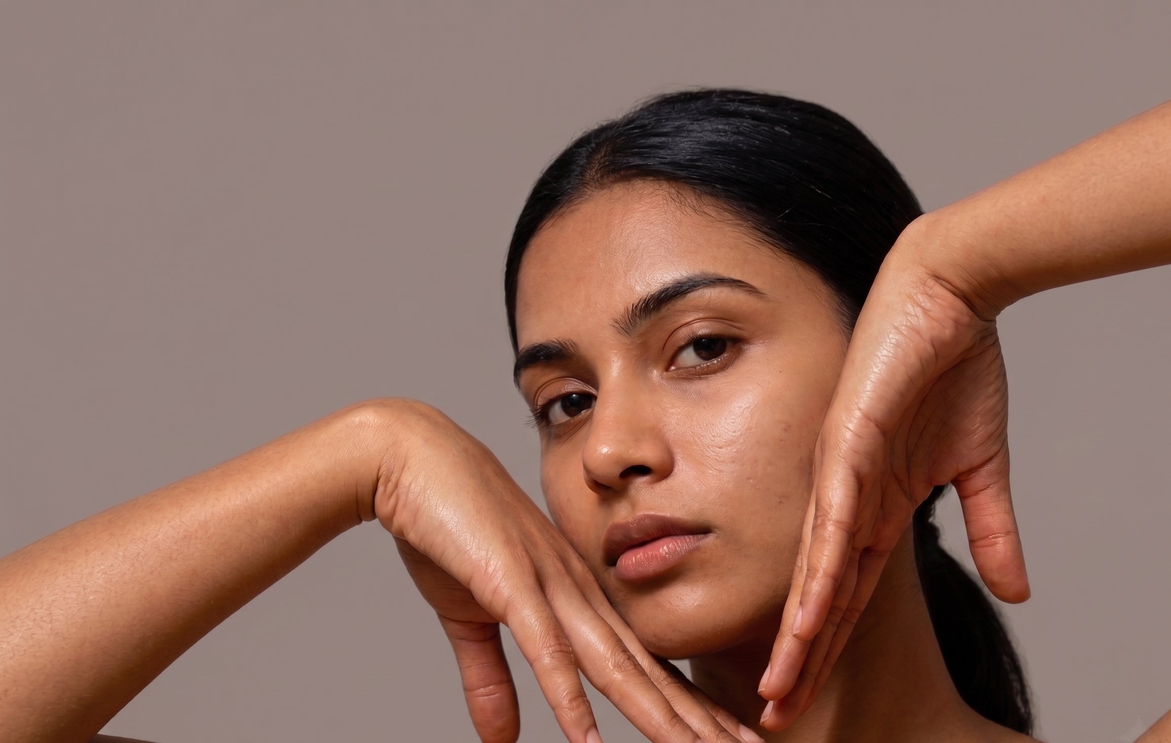 Personalised acne treatment