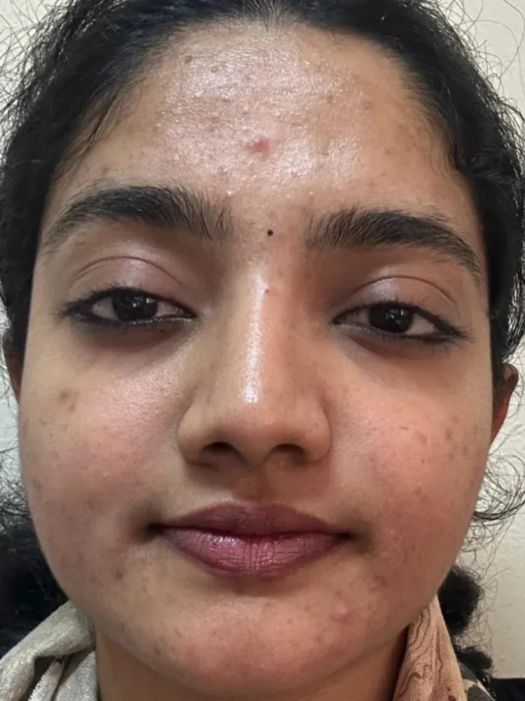 Aarohi before treatment