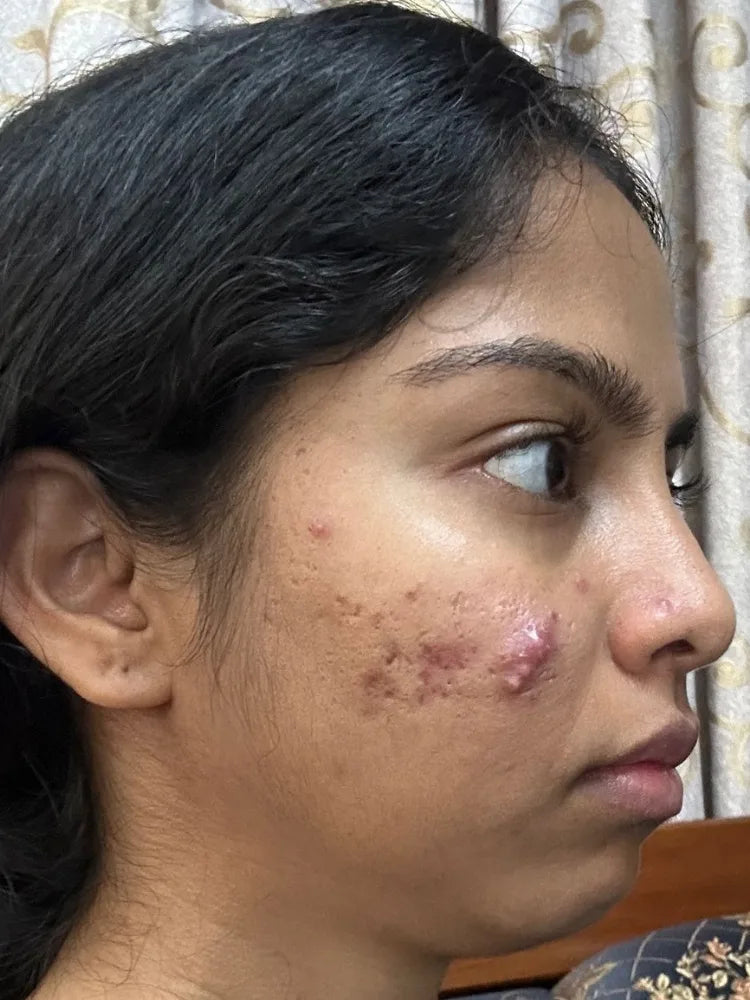 Anjali before treatment