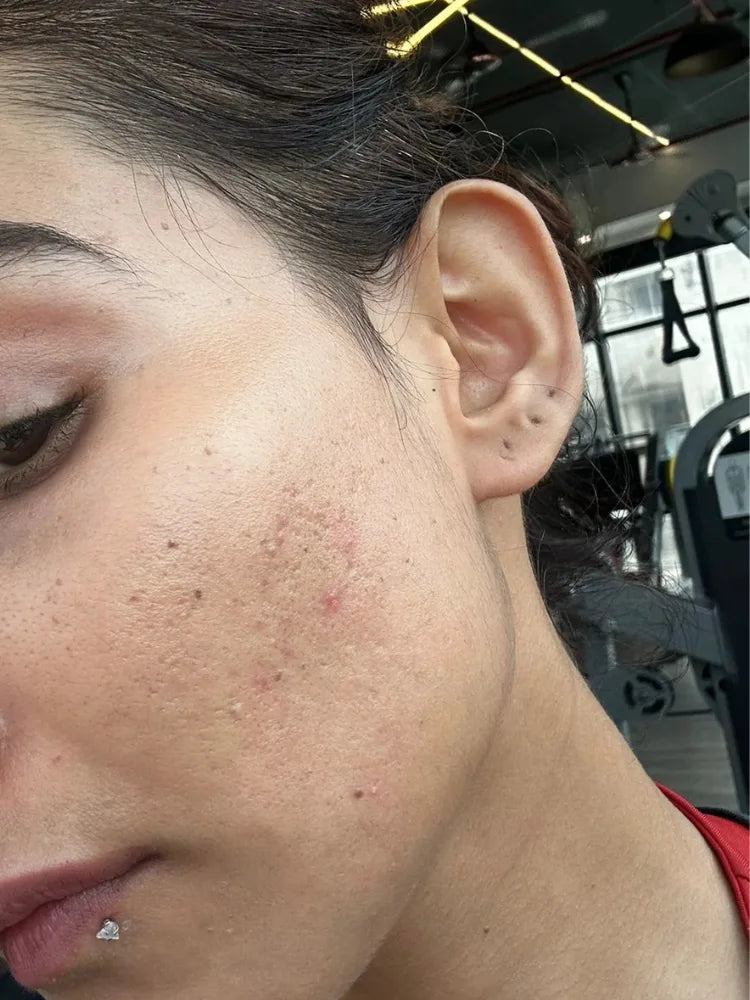 Sneha after treatment