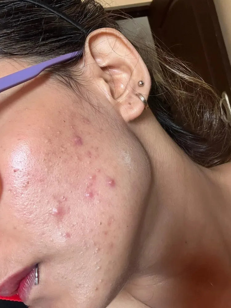 Sneha before treatment