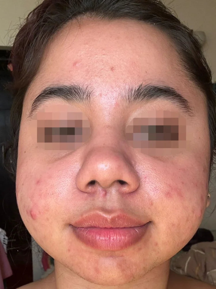 Tani, Jaipur before treatment