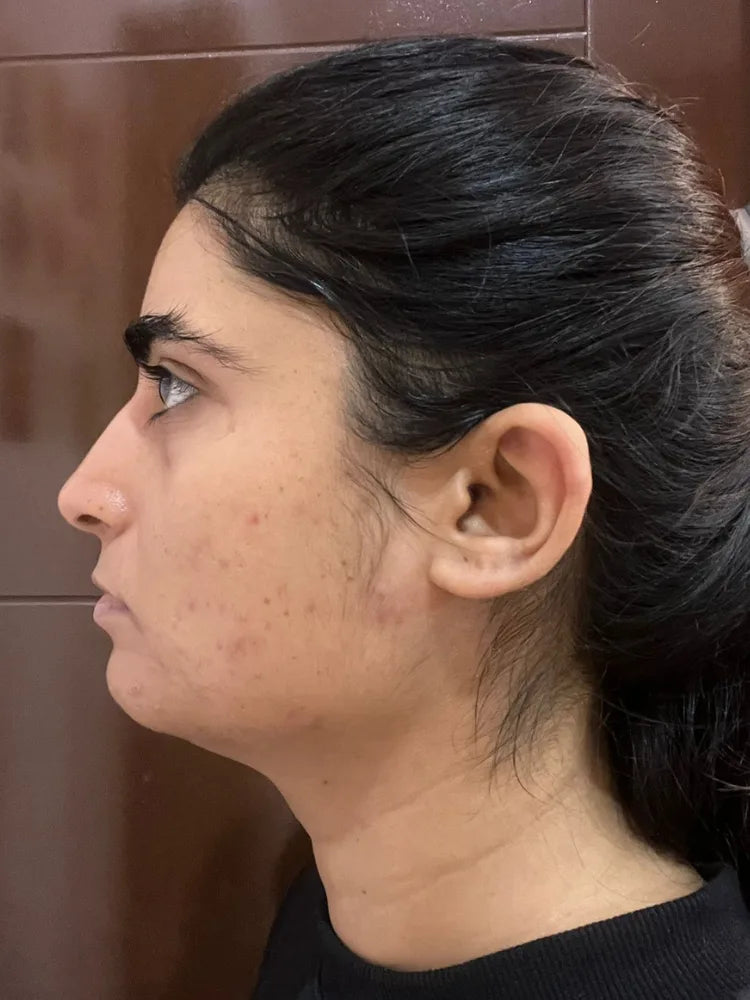 Yashvi after treatment
