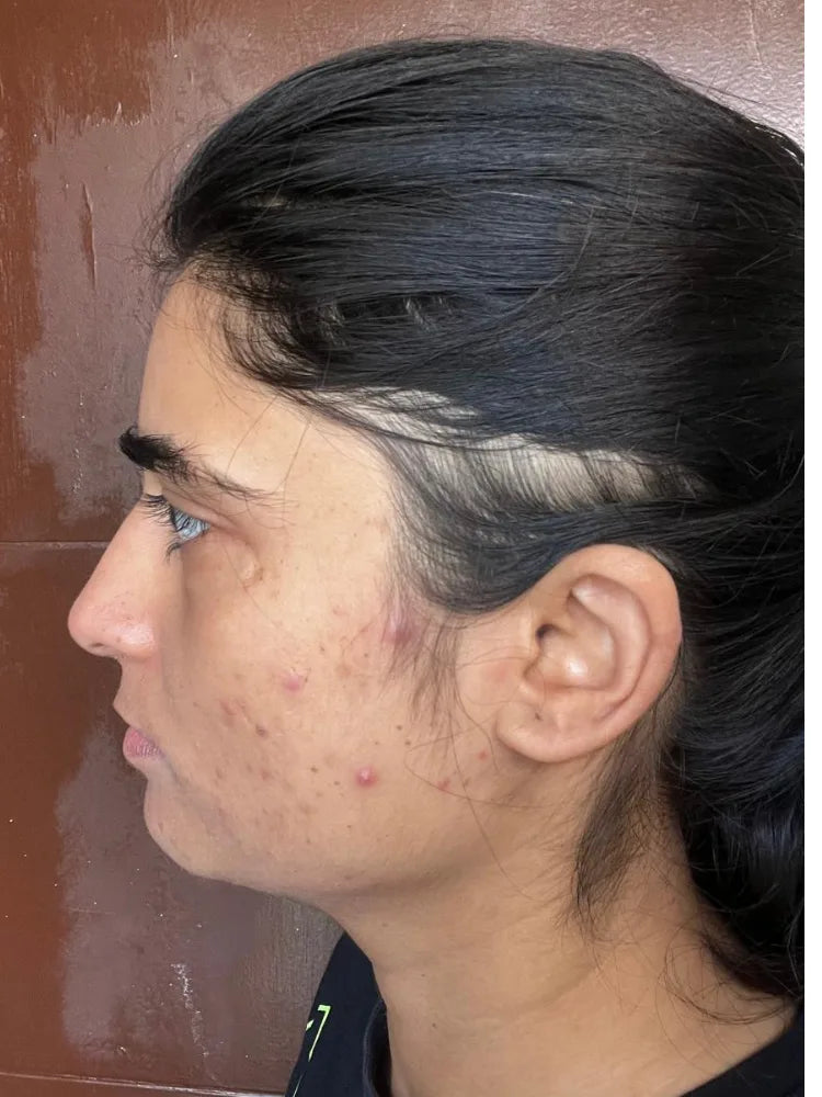 Yashvi before treatment
